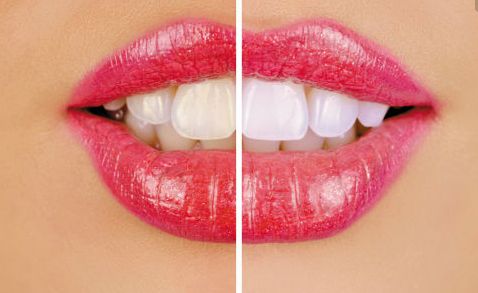 2023西安雙眼皮整形醫(yī)生綜合評價，一覽趙永政、劉小剛、王艷娜等5位專家豪華陣容