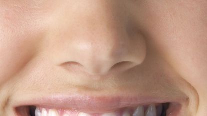 蘭州亞韓整形美容醫(yī)院面部脂肪填充效果如何？