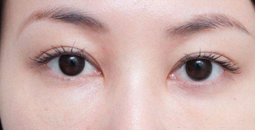 陜西省人民醫(yī)院皮膚科王星武解析面部祛斑的顯著效果