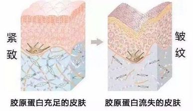 濟(jì)南整形醫(yī)院巔峰時(shí)刻！面部注射玻尿酸祛皺案例大揭秘