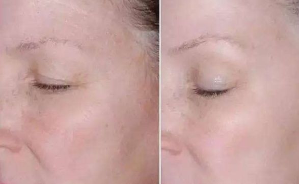 長(zhǎng)沙亞韓醫(yī)學(xué)美容醫(yī)院醫(yī)生及門(mén)診時(shí)間全揭秘