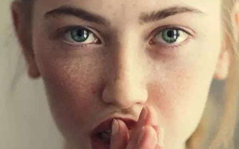 不用擔(dān)心！成都李競(jìng)醫(yī)生雙眼皮術(shù)：80天見證，效果驚艷