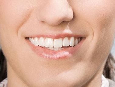 體驗(yàn)張鵬程醫(yī)生植發(fā)手術(shù)一年后的獨(dú)特見解