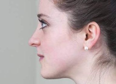 深圳隆胸求推薦？季瀅、李萬醫(yī)生對比！附胡華新案例&價格表參考