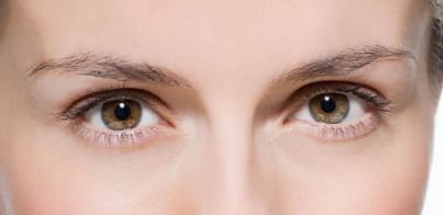 廣州唐畢做全切雙眼皮示范，師傅技藝展示+真實(shí)案例分享