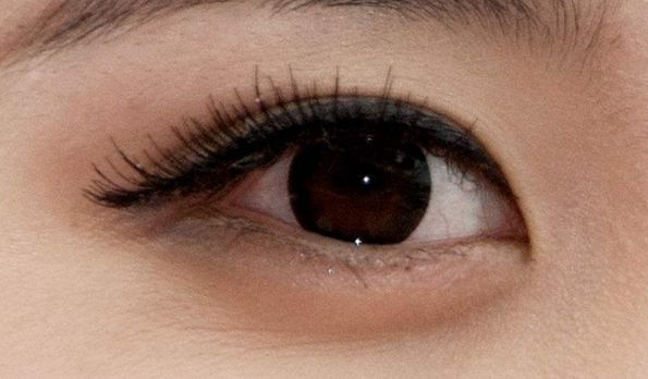 陳杰醫(yī)生的雙眼皮修復(fù)個人資料和案例分享