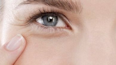 哈醫(yī)大一院為您推薦，祝仰東醫(yī)生：雙眼皮案例分享令人贊嘆！