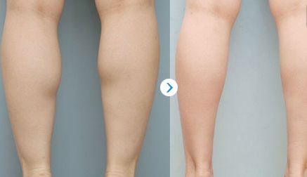 【更新】成都最權(quán)威的雙眼皮手術(shù)醫(yī)生Top5，不容錯過！