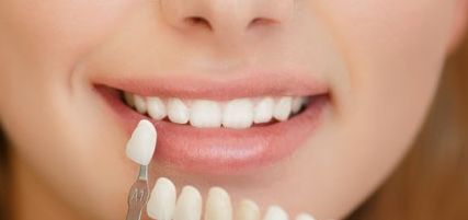 蘇薇潔醫(yī)生雙眼皮手術(shù)效果非常滿意，手術(shù)費(fèi)用參考清單來啦！