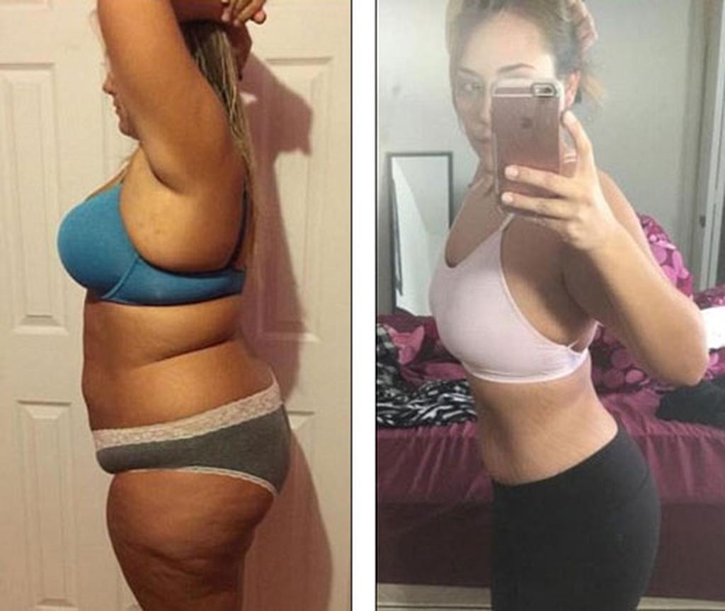 A型血如何有效瘦身