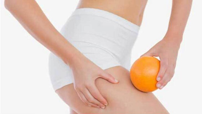 橘皮脂肪形成原因及防治措施