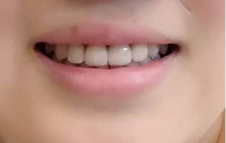 重慶市哪家整形醫(yī)院豐胸好，快速擴(kuò)充您的美麗魅力！