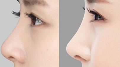 王一博的“臟臟包”又登上熱搜，小姐姐為何如此著迷？