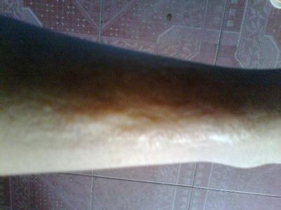 合肥蝶之星醫(yī)療美容醫(yī)生技術(shù)如何？哪些手術(shù)項目值得一試？動人之美是否能在這里找到答案？