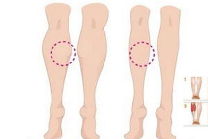 廣州美容醫(yī)生解讀，暢談吸脂技術(shù)專長(zhǎng)，走紅網(wǎng)絡(luò)！