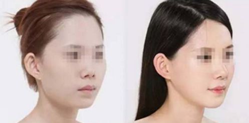蘇州韓式瘦臉手術醫(yī)院專家團隊排名前10！