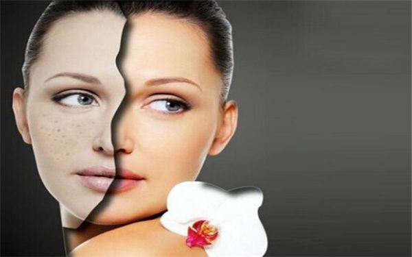 重慶黑色素醫(yī)療整形醫(yī)院排行榜：脈沖強(qiáng)光治療常年TOP10