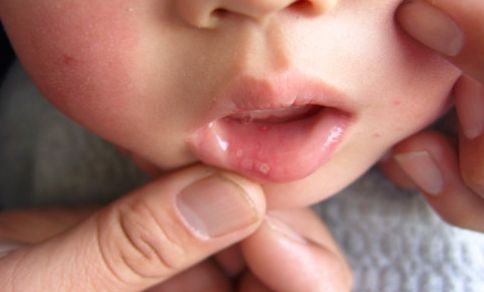 南京哪家醫(yī)院的面部抽脂效果比較好？