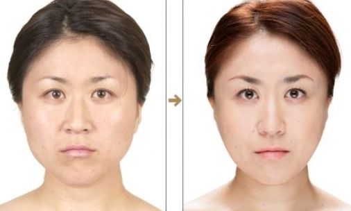 昆明線雕提升整形名醫(yī)口碑榜  權(quán)威機(jī)構(gòu)認(rèn)證