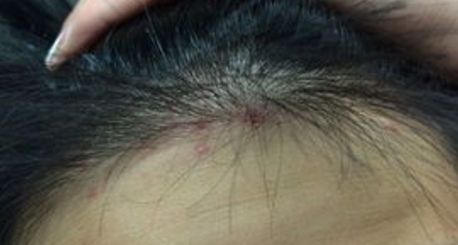 哈爾濱2023年最佳美容整形醫(yī)院，專業(yè)介紹！