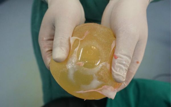 鄭州哪家醫(yī)院做面部提升效果好