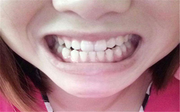 寧波星范吸脂是否值得信賴？有哪些值得注意的地方？