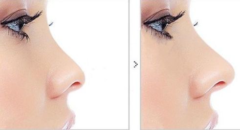 長春市哪家醫(yī)院的抽脂減肥效果較好，推薦一些知名機(jī)構(gòu)