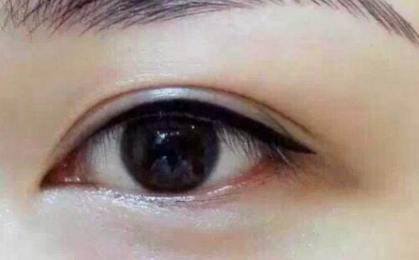 青島哪家醫(yī)院專業(yè)治療紅血絲效果好？