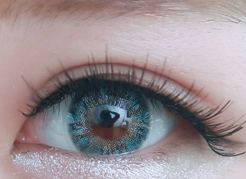 孫好杰脂肪填充值得嘗試嗎？