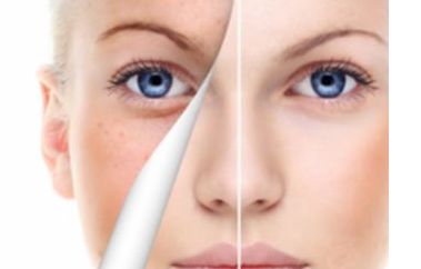 廣東黑眼圈治療最佳醫(yī)院及方法是哪些？