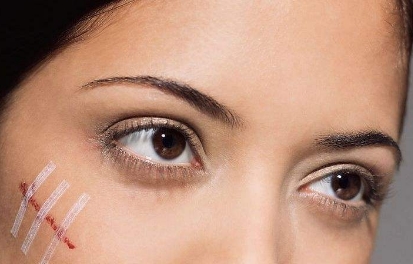 武漢微創(chuàng)小切口除皺術(shù)TOP10整形醫(yī)院大揭秘！