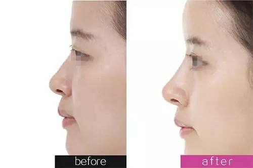 鄭州美萊和虎珂整形到底哪個(gè)更值得選擇？資歷、口碑、網(wǎng)友評價(jià)一覽對比真相如何？