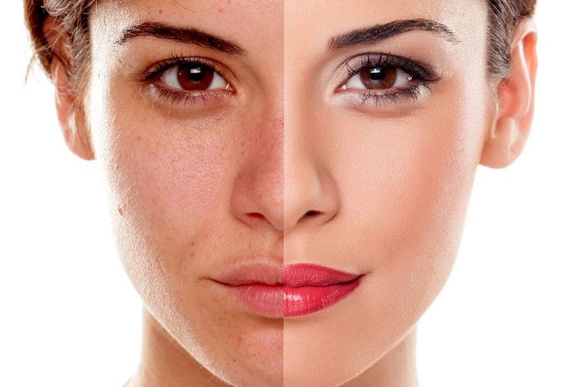 紹興注射肉毒素除抬頭紋醫(yī)院排行榜新鮮出爐