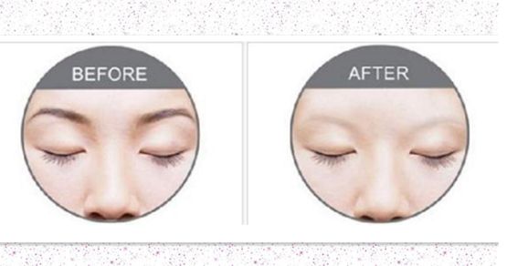 2023年最新青島隆胸醫(yī)院報告——全面解析！