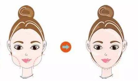 女子整形后鼻部變形，嗅覺受損成阿凡達(dá)一樣，教你如何避免整形風(fēng)險(xiǎn)