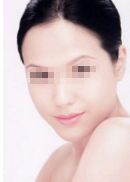 上海魯南楊明鼻部整形醫(yī)生資料簡(jiǎn)介及手術(shù)價(jià)格、口碑點(diǎn)評(píng)