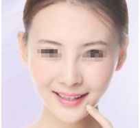 湖南溶脂針去雙下巴口碑佳，這十家醫(yī)院值得信賴