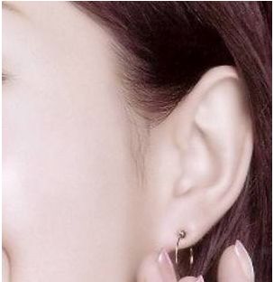 中山最贊脂肪填眼角紋醫(yī)院，技術(shù)秒殺雙眼皮