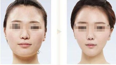 鄭州點陣祛老年斑醫(yī)院口碑實力榜單