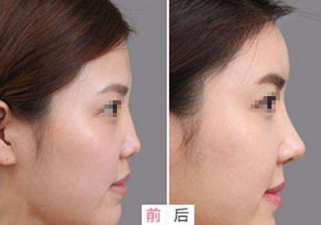 武漢市哪家整形醫(yī)院口碑好？