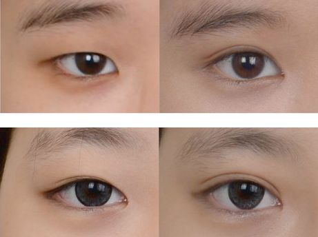 哈爾濱整形醫(yī)院綜合排名榜前十，哪家口碑最好？