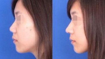 【2024】唐山最受歡迎的整容醫(yī)院排行榜公布！