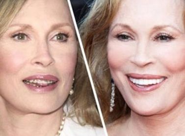 深圳疤痕治療專家推薦，效果好的醫(yī)院排行榜前5