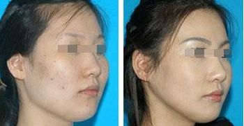 桂林整形醫(yī)院，哪家排名前3？