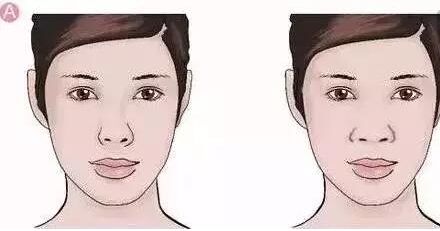 2024年淄博哪家醫(yī)院比較好做雙眼皮整形？推薦前四名