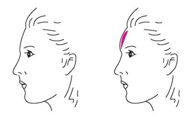 激光嫩膚手術前需要做哪些準備工作？
