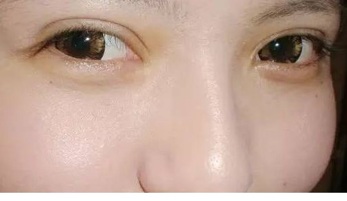 成都激光脫毛醫(yī)院競爭解析