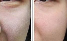 邵陽(yáng)市哪里能找到靠譜的豐胸醫(yī)院？