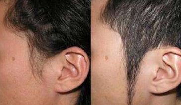 亳州哪家醫(yī)院打玻尿酸好 頂級推薦院所盤點