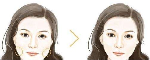 天津縮鼻翼手術(shù)哪家醫(yī)院價(jià)格實(shí)惠